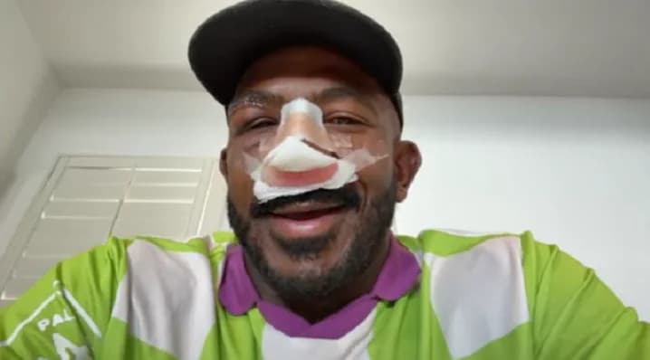 Khalil Rountree precisou passar por uma cirurgia no nariz após ser nocauteado por Alex Poatan (Foto: Reprodução)